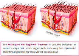 Keranique Hair Vitamins Hybrid : Hair Regrowth 